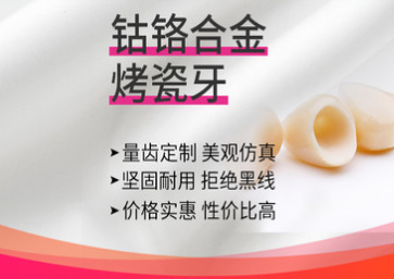 深圳?，攼?ài)康健口腔鈷鉻合金烤瓷牙價(jià)格貴不貴？收費(fèi)僅880元起！