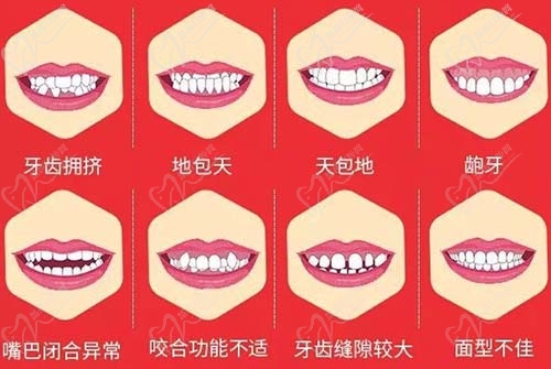 兒童早期干預(yù)適應(yīng)癥