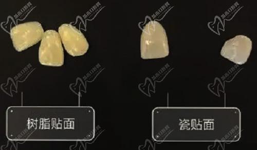 牙齒貼面的類(lèi)型