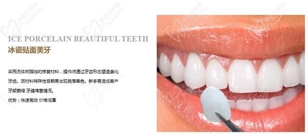 冰瓷牙和全瓷牙哪一個(gè)更好？看完冰瓷牙和全瓷牙的區(qū)別就明了