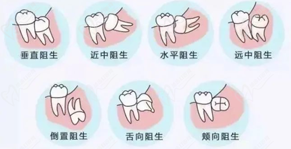 智齒