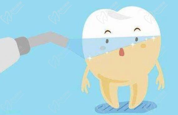 viva冷光美白是國(guó)產(chǎn)的嗎？