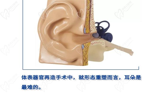 趙絳波醫(yī)生耳再造費用
