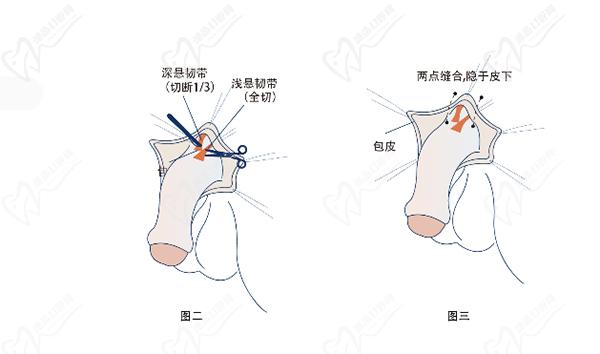 重慶星榮整形醫(yī)院李世榮預(yù)約掛號時(shí)間