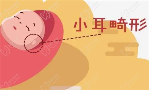 什么是耳畸形？哪些情況需要治療？