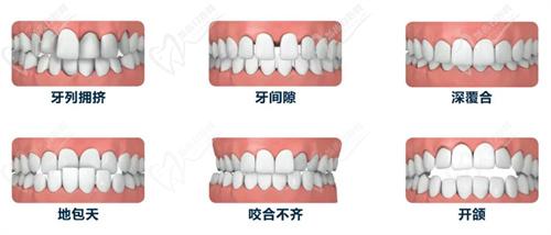 杭州整形醫(yī)院口腔科牙齒矯正多少錢？