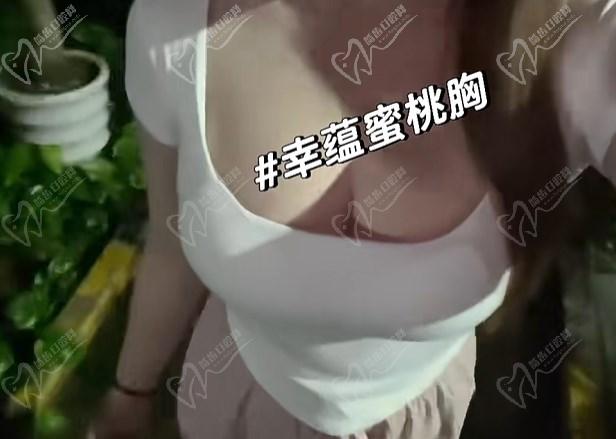 泰國整形醫(yī)院隆胸手術在線預約
