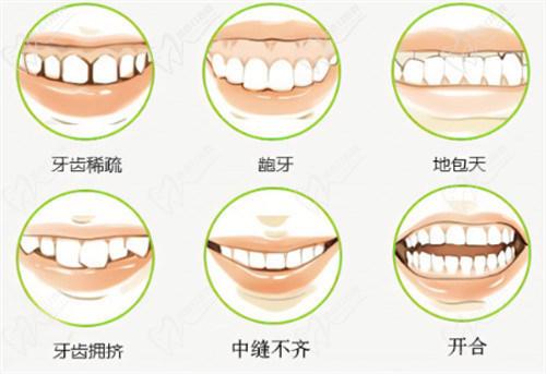 南寧柏樂口腔醫(yī)院牙齒矯正多少錢？