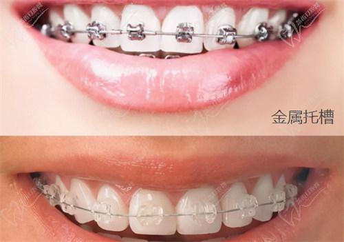 周嫣醫(yī)生技術(shù)優(yōu)勢在哪里？