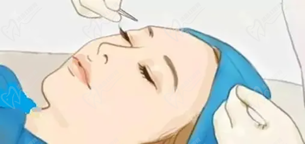 劉哲延雙眼皮