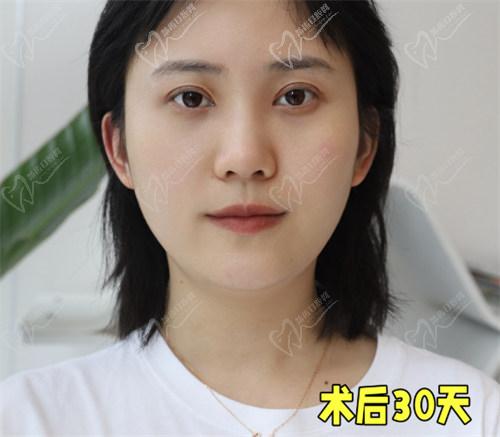 術(shù)后30天的恢附情況：初期消腫和寬度變化