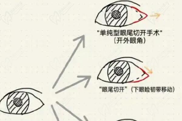 王衡健雙眼皮是雜牌子嗎
