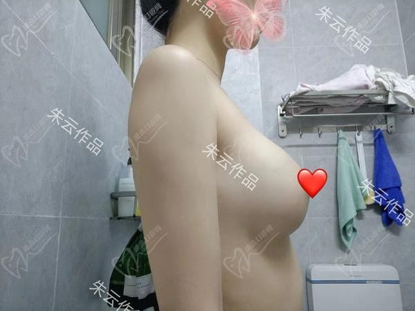中家醫(yī)朱云隆胸怎么樣