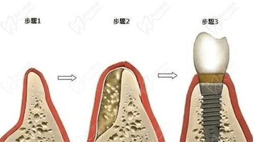 深圳衛(wèi)佳康口腔醫(yī)院地址