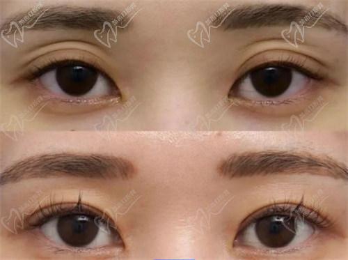 師麗麗的實例可信嗎?是不是營銷出來的?
