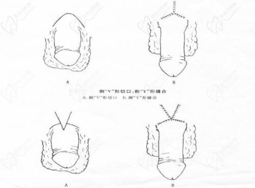 李世榮延長手術的高定價，本質上是醫(yī)療價值的真實體現
