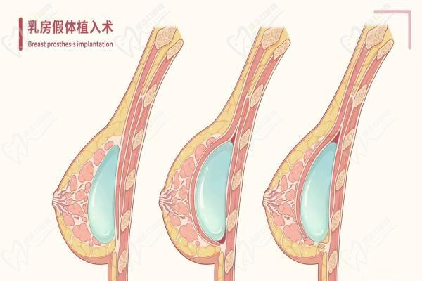 深圳陽(yáng)光整形醫(yī)院醫(yī)生團(tuán)隊(duì)