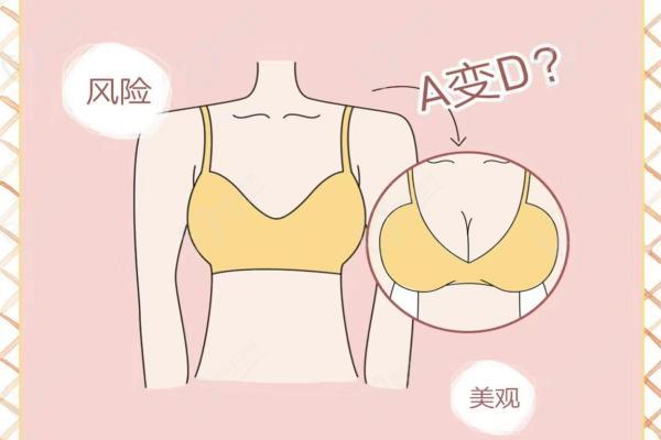 深圳陽(yáng)光整形醫(yī)院隆胸怎么樣？?jī)?nèi)窺鏡隆胸技術(shù)好價(jià)格16800元起