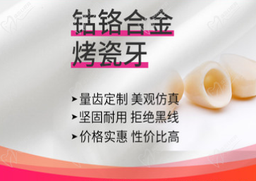 深圳?，攼劭到】谇烩掋t合金烤瓷牙價(jià)格貴不貴？收費(fèi)僅880元起！