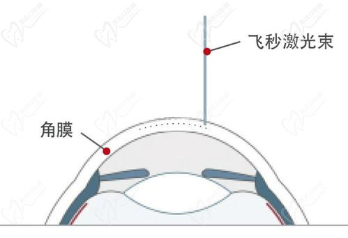 王曉瑛醫(yī)生在哪里出診？上海普瑞、上海和平等眼科醫(yī)院可預約