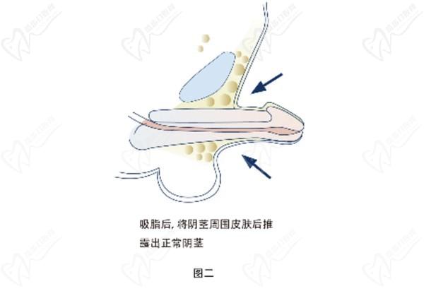 重慶李世榮教授坐診時間及在線預(yù)約開啟！想“變強”做男科手術(shù)找李世榮男性健康管理中心準沒錯