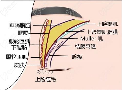 師麗麗雙眼皮修復成功率大嗎？看了好多真人修復實例和口碑評價無黑料