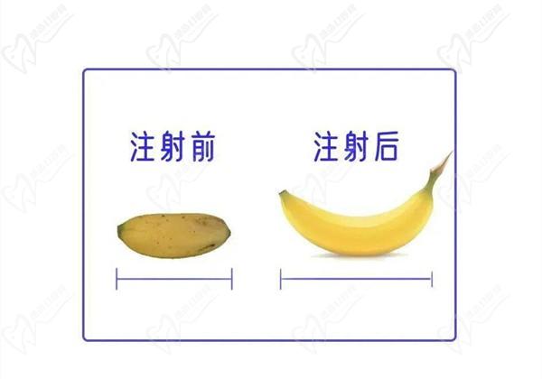 李世榮做一次延長手術(shù)多少錢？2025年李世榮男科價格表延長手術(shù)4.5w+假體植入3w+注射增粗5萬起