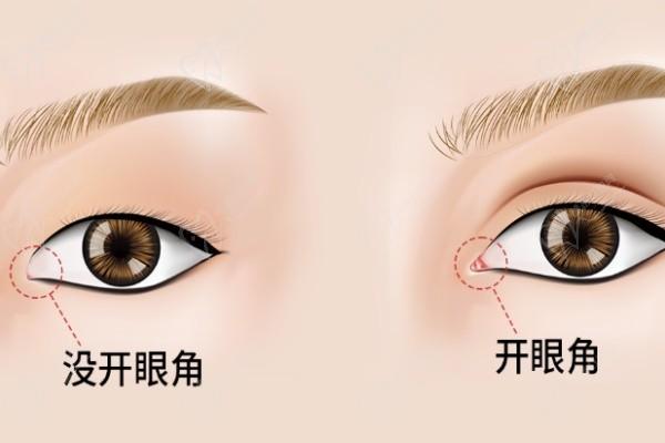 王衡健雙眼皮是雜牌子嗎知乎澄清不是-是九院正規(guī)雙眼皮高檔次修復(fù)醫(yī)生